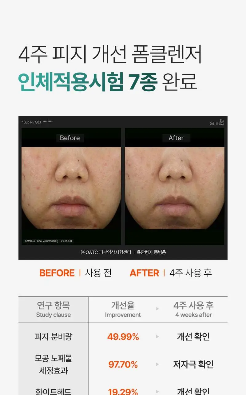 [피지/모공케어] 피캄 언더포어 바테카 폼 클렌징 150ml 상세페이지 25